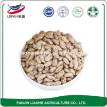 speckled kidney beans - product's photo