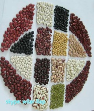 red/white/black/light speckled kidney beans. - product's photo