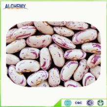 light speckled kidney beans(long shape) - product's photo