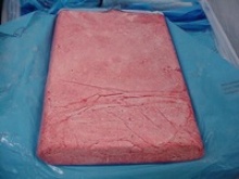 frozen mdm chicken meat  - product's photo