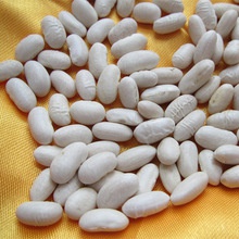 chinese dry white kidney beans yunnan white kidney beans - product's photo