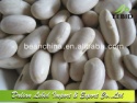new crop big white kidney beans - product's photo