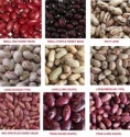 beans - product's photo